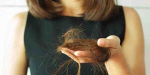 Alopecia por estrés