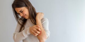 Descubre cómo eliminar la dermatitis por estrés de forma efectiva