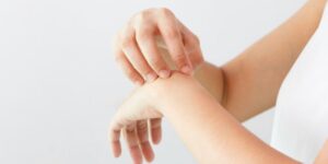 Eczema en las manos por estrés