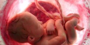Estrés fetal