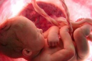 Estrés fetal