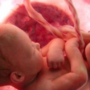 Estrés fetal