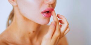 Hinchazón de labios por estrés