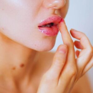 Hinchazón de labios por estrés