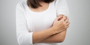 Manchas dermatitis por estrés