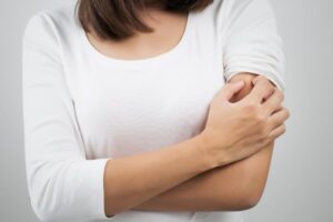 Manchas dermatitis por estrés