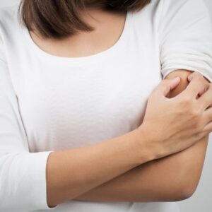 Manchas dermatitis por estrés