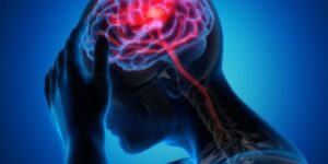 Neuro estrés
