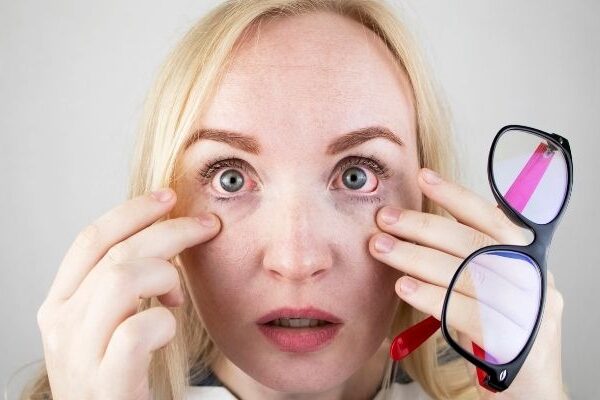 Ojos rojos por estrés