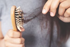 Pérdida de cabello por estrés