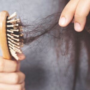 Pérdida de cabello por estrés