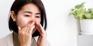 Alergia por estrés y ansiedad