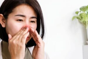 Alergia por estrés y ansiedad