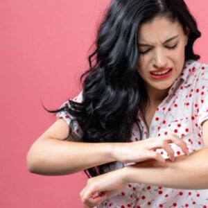 Alergias en la piel por estrés tratamiento