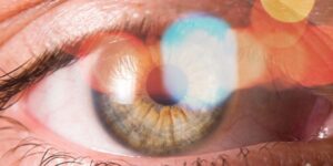 Destellos de luz en los ojos por estrés