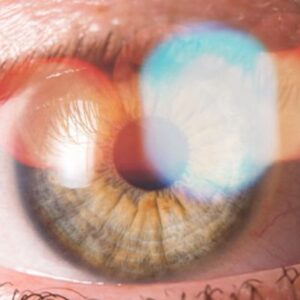 Destellos de luz en los ojos por estrés
