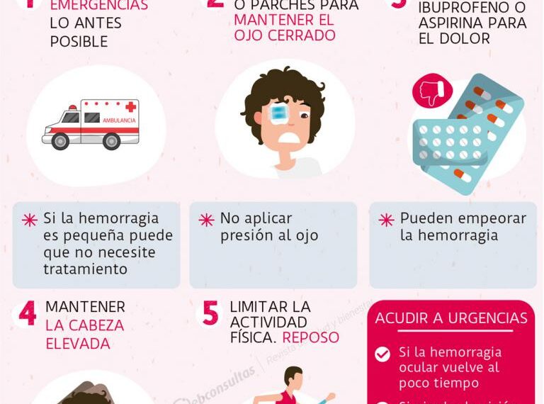 Como quitar el dolor de ojo por estrés