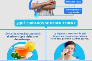 Dermatitis atópica alergias en la piel por estrés