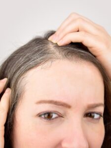Las canas salen por estrés