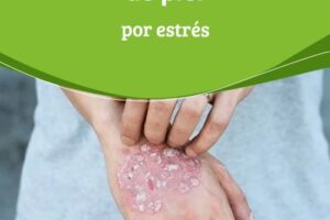 Problemas en la piel por estrés