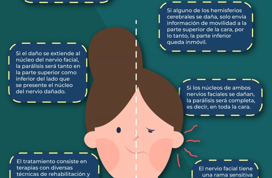 Tratamiento síntomas de parálisis facial por estrés