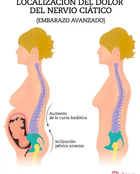 Cómo aliviar el estrés en el embarazo