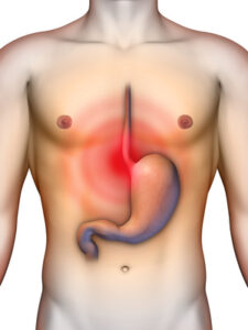 Como el estrés puede afectar el estómago y el colon