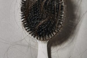 La pérdida de cabello por estrés se recupera