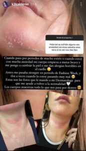 Que puede causar el estrés en la piel