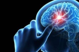 ¿Cómo desinflamar el cerebro por estrés