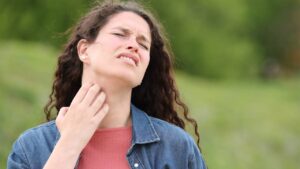 Tipos de dermatitis por estrés